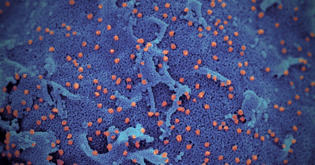 After 24 hours in culture there are large numbers of orange viral particles on the surface of the cell (blue). 